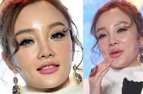 娱乐圈没整过容的明星_孙菲菲整容后无戏可拍_娱乐圈整容女明星名单